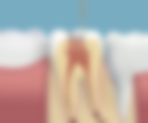 种植牙比较好的品牌，在国内的口碑怎么样？