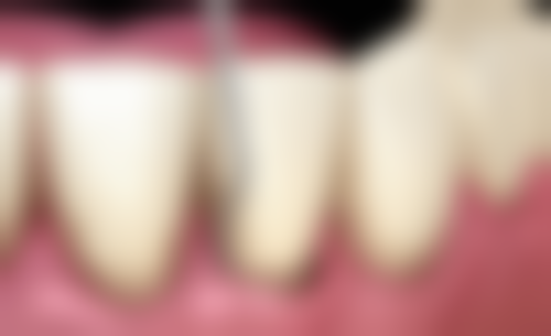 陈云芳医生技术特点