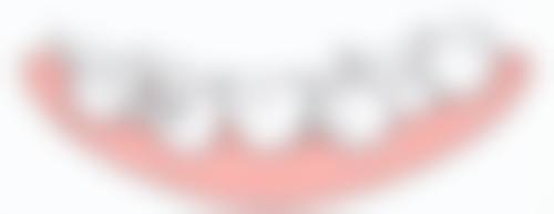 根管治疗一次完成的治疗流程是怎样的