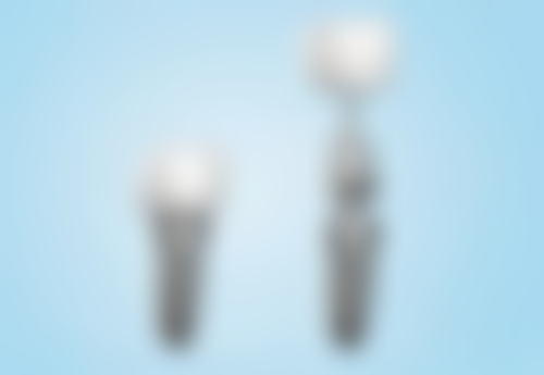 补牙时间受哪些因素影响