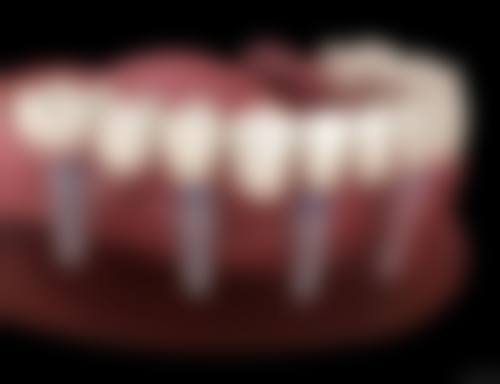 深圳嘉贝口腔诊所价格表：透明合理的收费