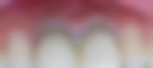 湖南株洲博尔口腔价格表：合理收费透明公开