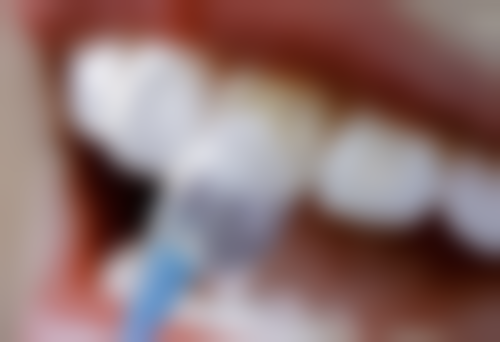 艾伟健医生擅长的项目