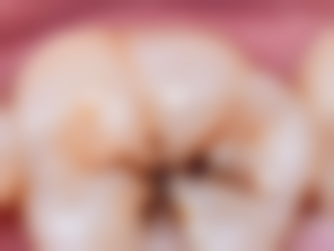 下午拔牙的时机怎么把握才安心