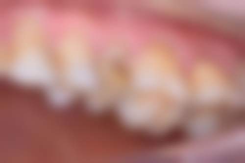 杭州口腔医院大江东门部口碑怎么样：患者的真实评价是更好的证明