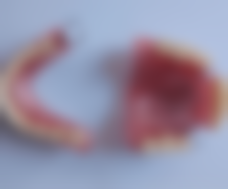 浙江杭州优贝口腔门诊部价格表