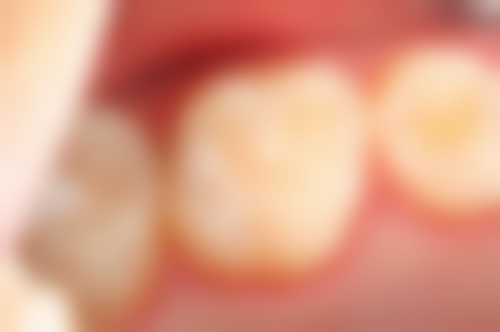 杭州口腔医院大江东门部擅长项目：牙齿的“专属定制”