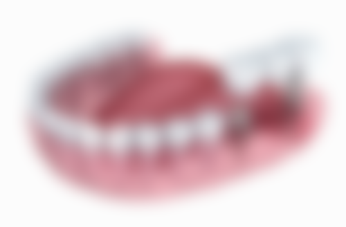 广东深圳米奇口腔门诊部口碑怎么样