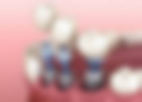 广东深圳米奇口腔门诊部预约挂号方式