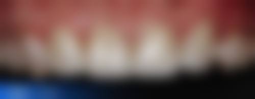 广州穗华口腔医院（花都院区）口碑怎么样