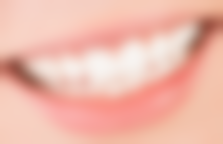 取牙后如何确定至佳补牙时间