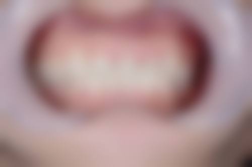 山东菏泽加美口腔医生名单：专精团队为你护航