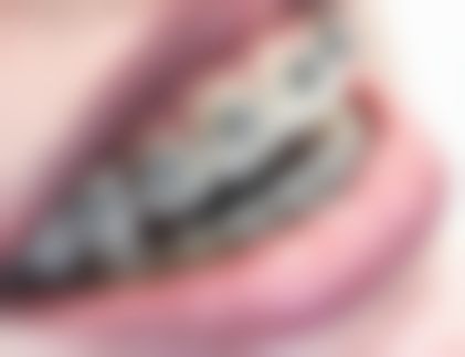 郑春颖医生技术特点：精细与创新并存