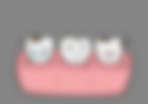 余姚丽齿口腔诊所擅长项目