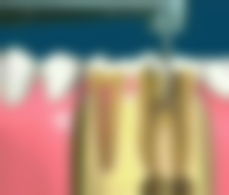 王东山医生怎么预约挂号