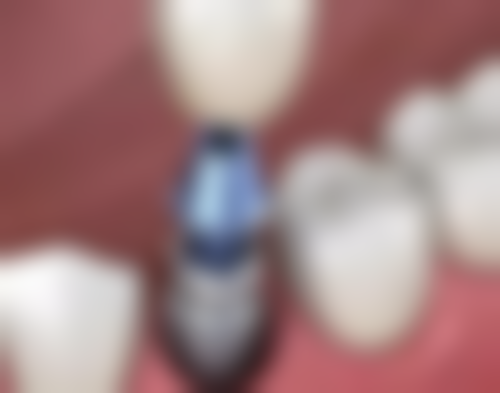 湖南湘潭玉笑口腔真实实例