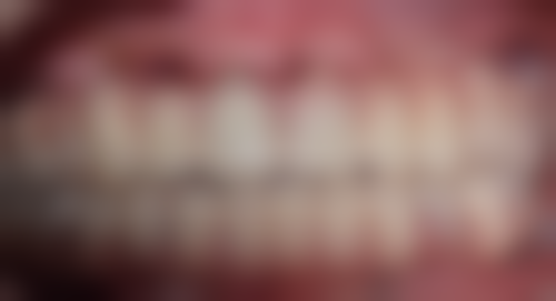 西安新城每颗一生口腔门诊部擅长项目