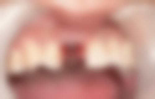 广西柳州牙印象口腔医院营业时间