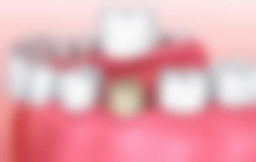 每年洗牙一次能改善牙齿美观吗