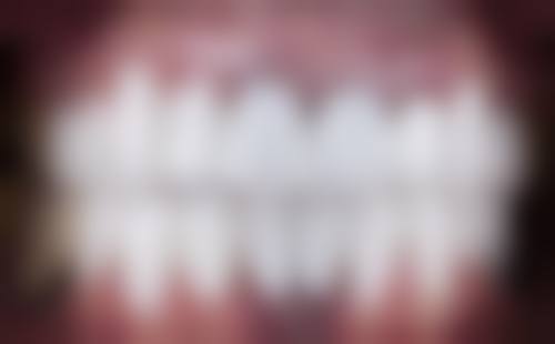 苍溪县人民医院口腔科价格表