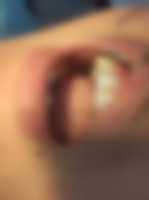 江苏南京江北名瑞口腔真实实例