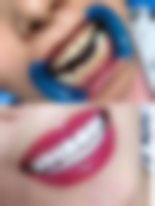 永州龙山口腔真实实例：见证神奇的改变