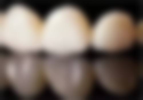 深圳铭德口腔口碑怎么样：患者真实评价见分晓