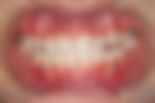 广东江门开平众顺口腔预约挂号方式：简单便捷不麻烦