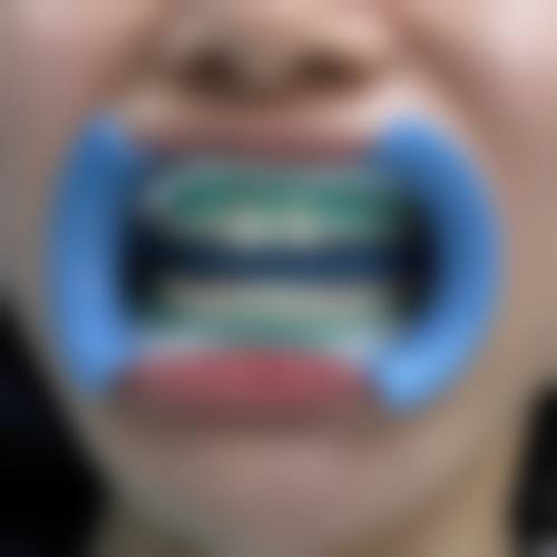 深圳铭德口腔仪器设备：精良科技助力看牙