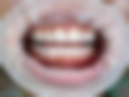 巴彦淖尔市豆牙口腔仪器设备