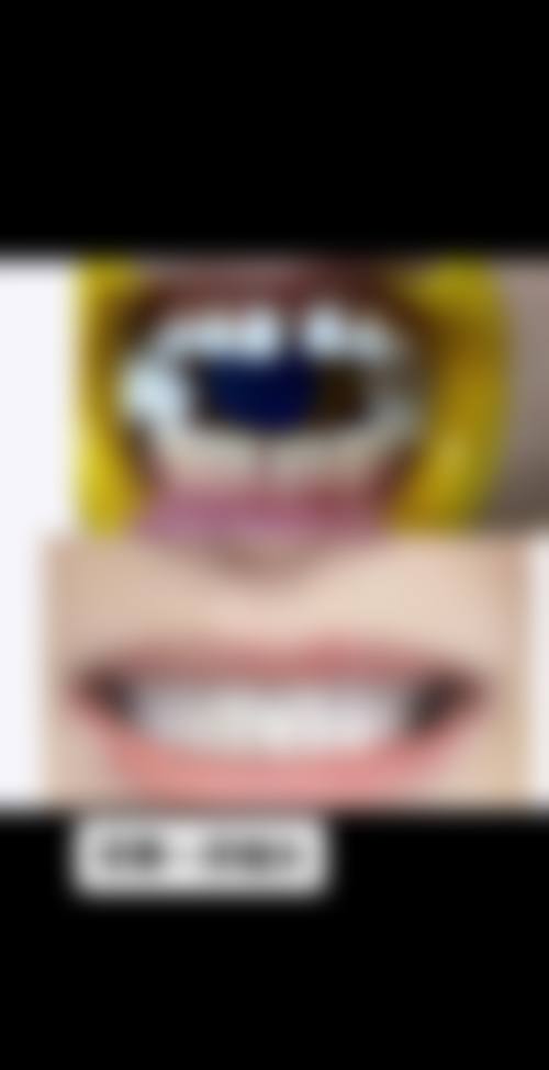 福州台江牙牙巴士口腔门诊部真实实例