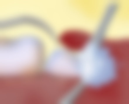 谌东明医生怎么预约挂号