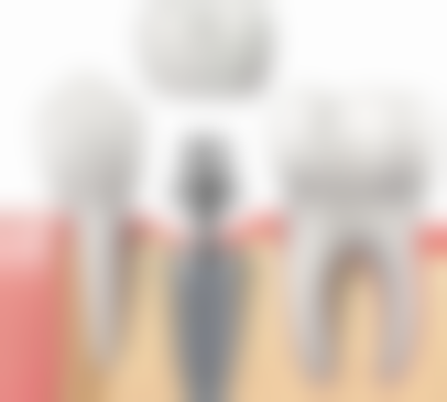 宝鸡美牙乐口腔门诊部真实实例