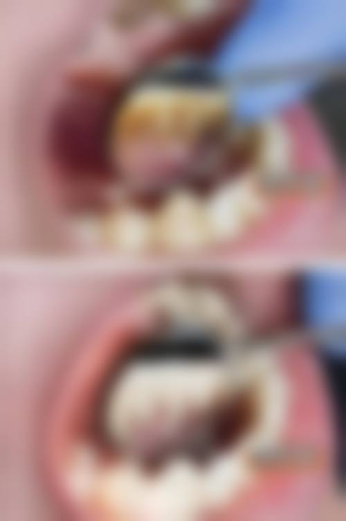 东莞金中口腔（石碣四甲分店）医生名单及实力