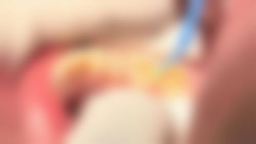 无锡宜兴市康齿口腔预约挂号方式：多种选择超便捷