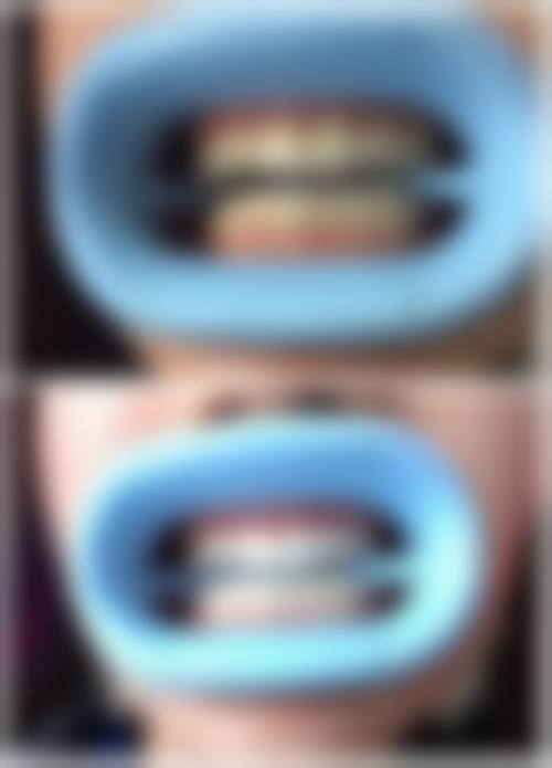 新疆阿克苏芽芽康美口腔价格表