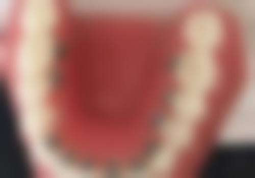 淮安诺贝尔口腔医院擅长项目：多样技术满足不同需求