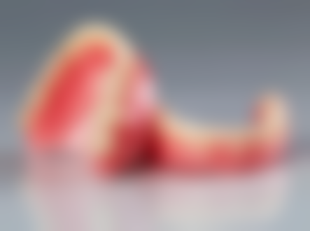 申云芳医生真实实例：见证神奇的口腔蜕变