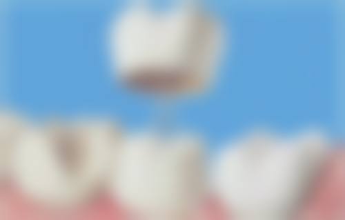 孝感益美口腔口碑怎么样