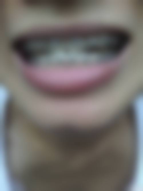 山东济南国宁口腔口碑怎么样