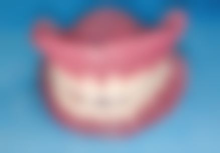 根管预备与充填过程中需要注意什么