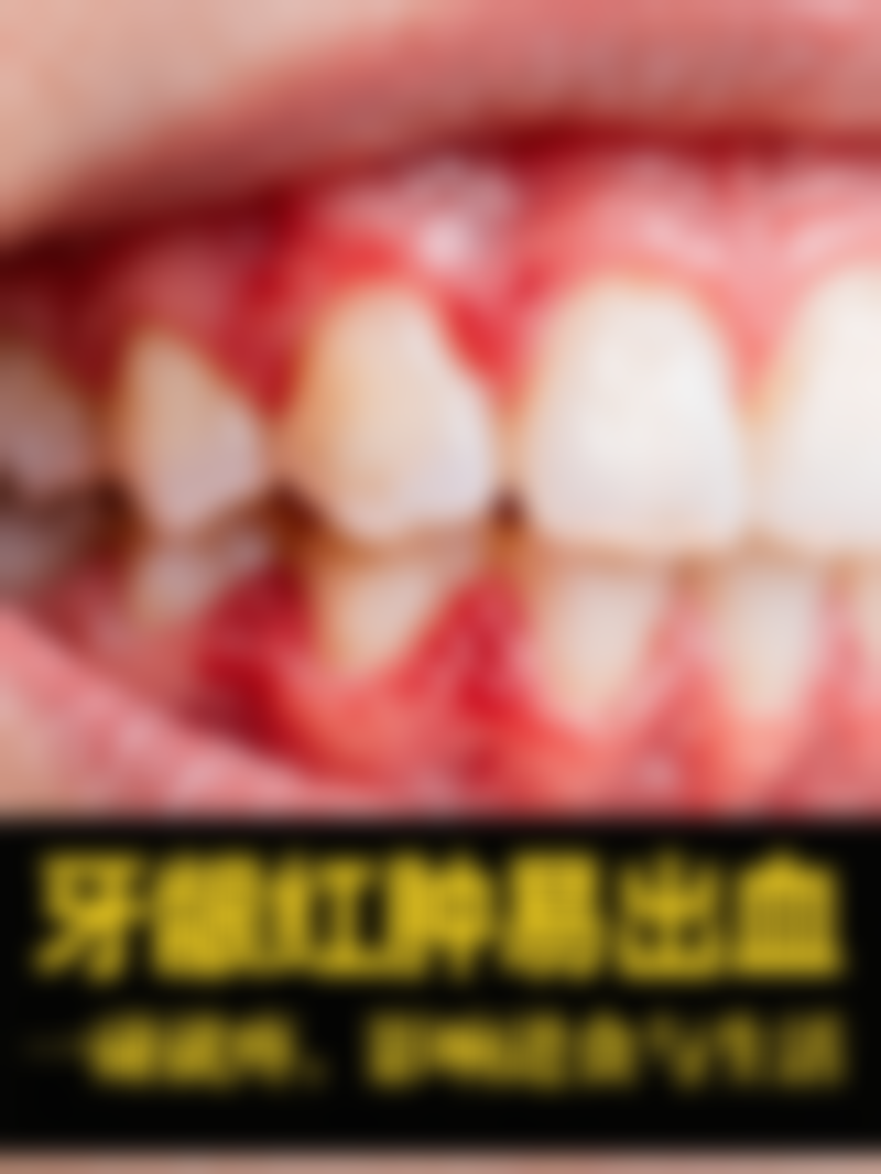 补牙后用牙线剔牙靠谱吗？