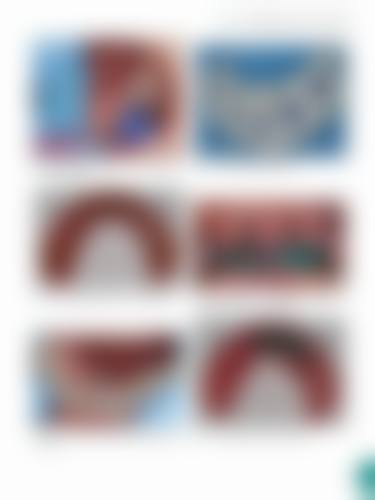 襄阳襄城区维乐口腔医院价格表