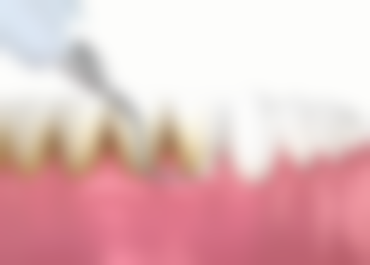 邱凌峰医师擅长项目：全方面解决口腔问题