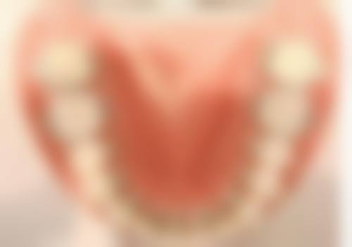 南宁牙百年口腔（星湖路分店）口碑怎么样