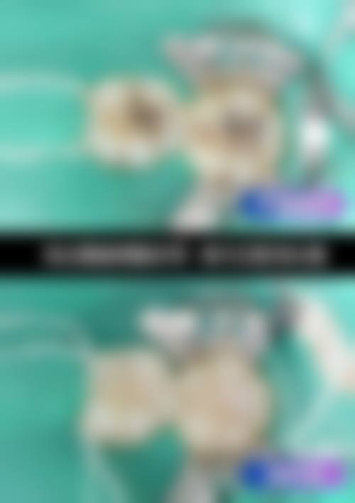 广东惠州博罗佳美杰口腔门诊部价格表