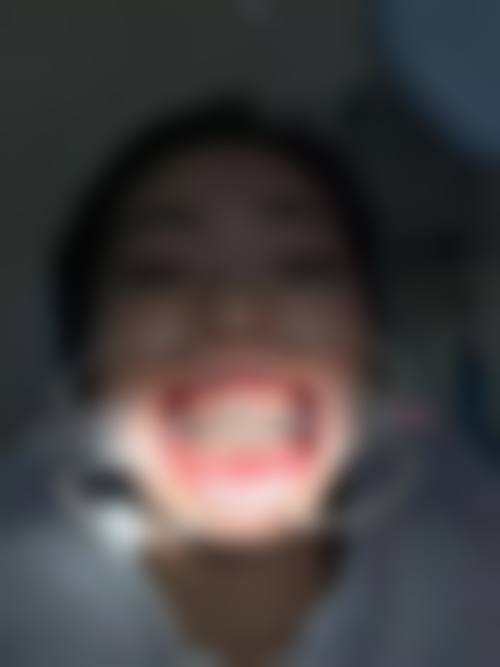 江苏盐城周仁强口腔科诊所擅长项目