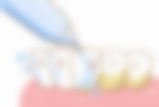 泉州牙博士口腔医院价格表：透明合理性价比高