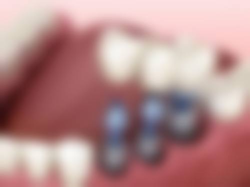安阳滑县正大口腔医院擅长项目