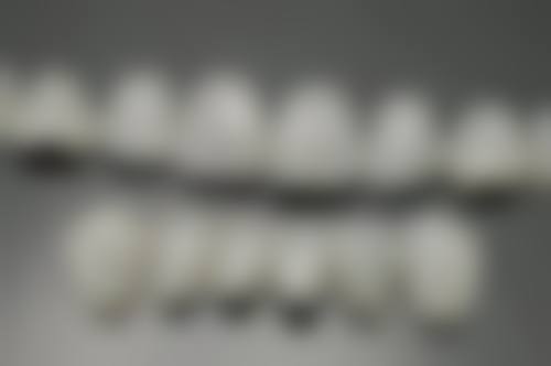 地包天骨性矫正找专精口腔机构靠谱吗